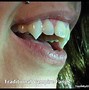 Image result for Vampire Fangs D3R