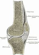 Image result for Thumb Basal Joint Arthroplasty