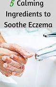 Image result for Severe Eczema Treatment