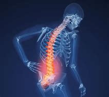 Image result for Lower Back Bone Pain