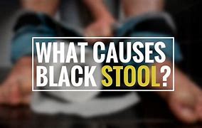 Image result for Black Tarry Stools Common Causes