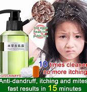 Image result for Lice Shampoo