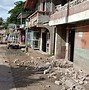 Image result for Earthquake Injuries Burn