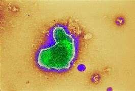 Image result for Respiratory Syncytial Virus Paramyxovirus