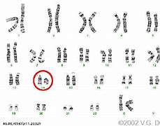 Image result for chromosom_14