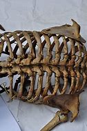 Image result for Shell Back Brace Spine