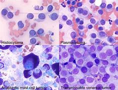 Image result for Round Cell Sarcoma