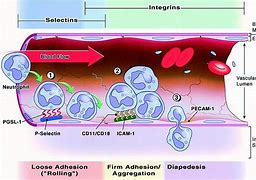 Image result for Acute Inflammation Process