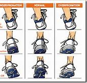 Image result for Too Small Shoes Feet
