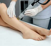 Image result for Most Effective Laser Hair Removal