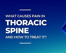 Image result for Thoracic Spine Pain Symptoms