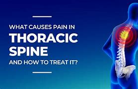 Image result for Thoracic Spine Nerve Pain