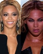 Image result for Beyoncé Plastic Surgery