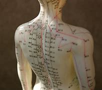 Image result for Types of Acupuncture
