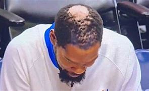 Image result for Kevin Durant Bald