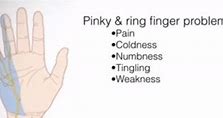 Image result for Ring Finger Numbness