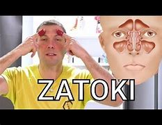 Image result for co_to_znaczy_zespół_zatoki_szyjnej