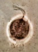 Image result for Trichomoniasis Bacteria