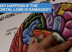 Image result for Frontal Lobe Bitten Off