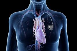 Image result for cardiogrsf�a