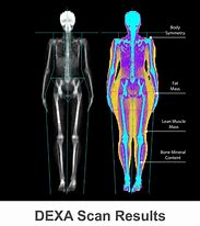 Image result for Dexa Scan BMI