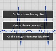 Image result for co_oznacza_załamek_t