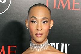 Image result for MJ Rodriguez Before and After