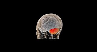 Image result for Little Brain