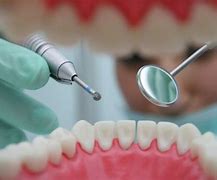 Image result for Dental Drills Types