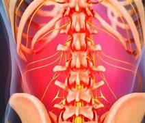 Image result for What Are Signs of Muscle Spasms in Back