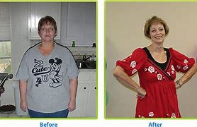 Image result for Before and After Weight Loss Diet