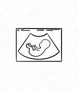Image result for Anencephaly Fetal Ultrasound