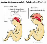 Image result for Anencephaly Animals