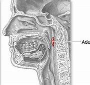 Image result for addnoides