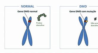 Image result for DMD Chromosome