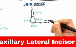 Image result for Right Lateral Insicor Drawing