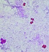 Image result for Diplococci Gram Stain