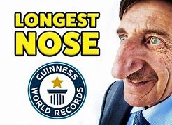 Image result for Guinness World Record Biggest Nose