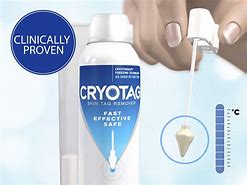 Image result for Cryo Skin Tag Remover