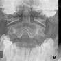 Image result for Spine as Known C1 to C7