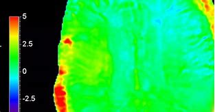 Image result for Philips Ingenia 3T MRI