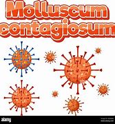 Image result for +Virus Moluskum
