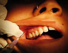 Image result for How Does Anesthesia Work