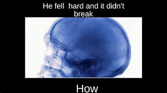 Image result for Skull Break Meme