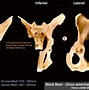 Image result for Pelvic Bone Identification