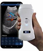 Image result for Ultrasound Machine iPhone