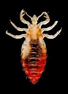 Image result for Body Louse