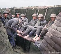 Image result for WW1 Trench Feet