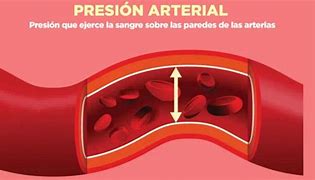 Image result for Que ES La Presion Arterial