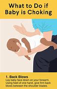 Image result for Recover CPR